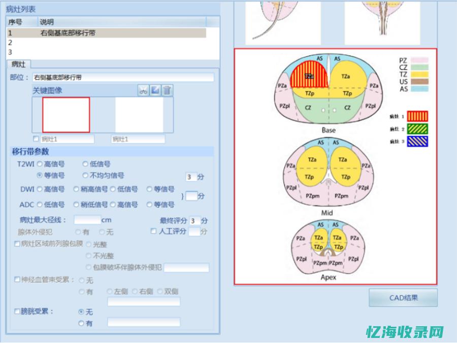 全面解析备案域名购买流程及注意事项 (备案解除是什么意思)