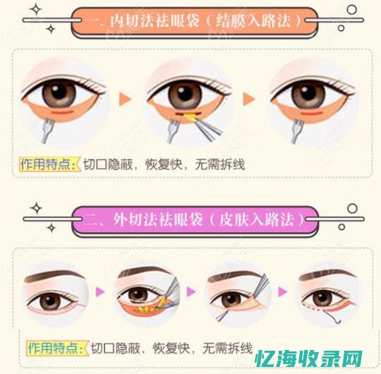 成都做眼袋手术大概要多少费用