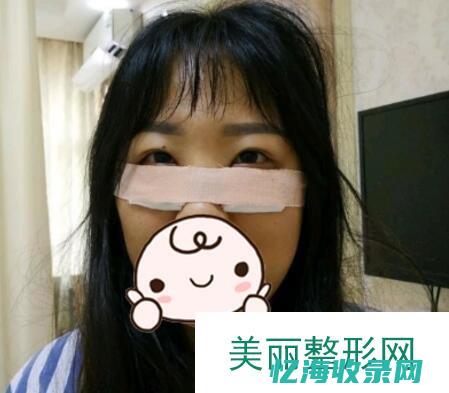 重庆做眼袋哪家做得好 (重庆做眼袋哪个医生好)