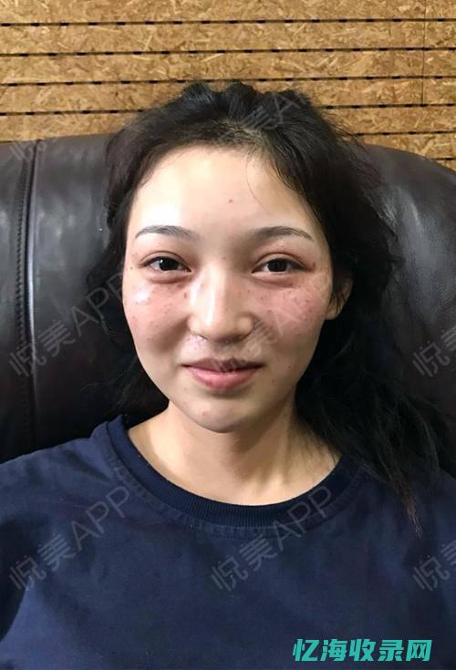 重庆做眼袋哪个好