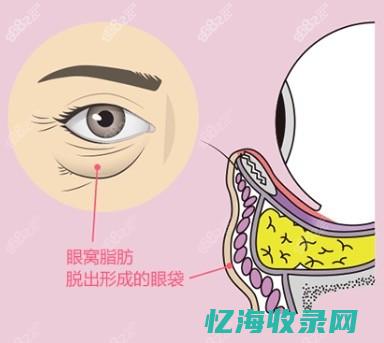 重庆做眼袋哪家做得好 (重庆做眼袋哪家医院最好)