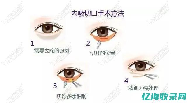 重庆做眼袋哪家做得好