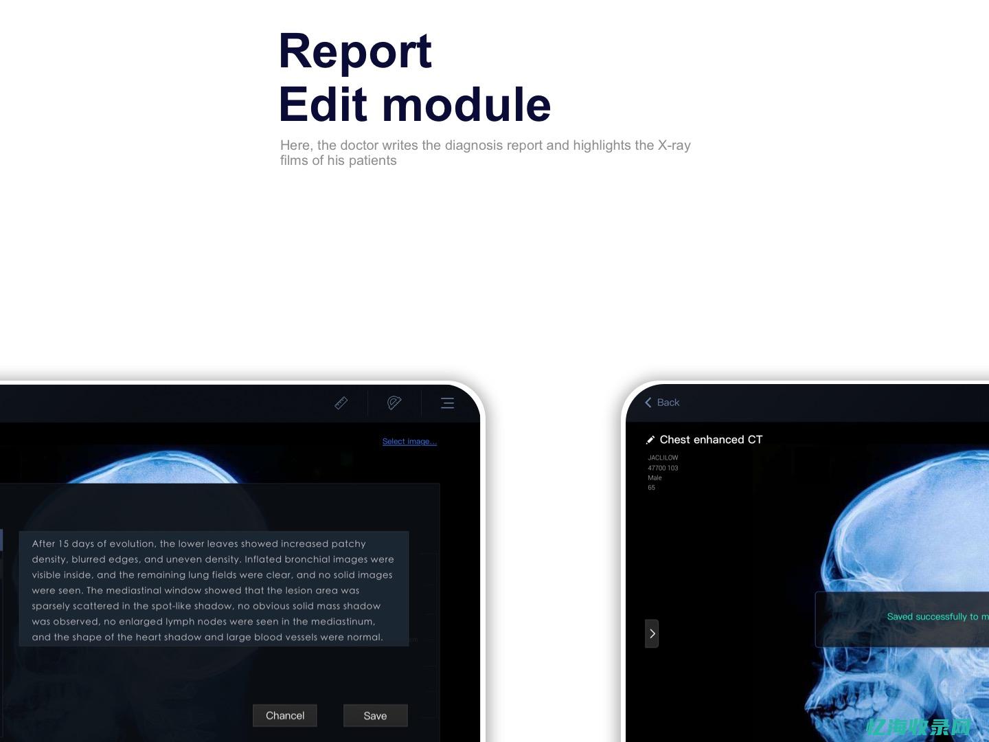 网站诊断网站seo诊断 (网站诊断网站是什么)